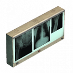 X線ディスプレイライト（フル・POI）